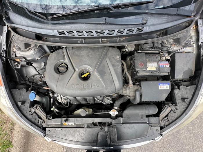 2013 hyundai elantra limited with 143526 miles for sale near elk-river, minnesota 19d20336b81b45ada2d0f8d6847e7a7f.jpeg