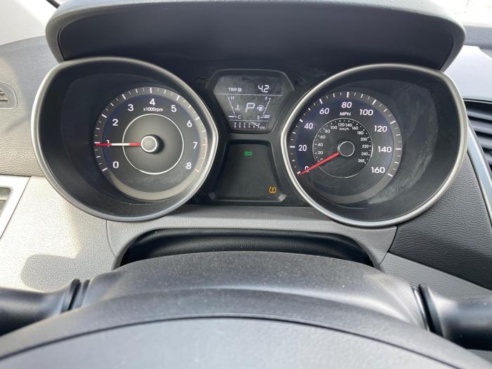 2015 hyundai elantra limited with 111174 miles for sale near rice, minnesota 8824f9bb95a743e9b11e58c43d2c9a19.jpeg