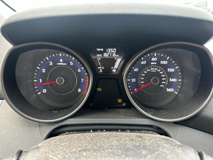 2013 hyundai elantra limited with 182716 miles for sale near elk-river, minnesota bfac2558ba204d1d98f26fb936434196.jpg